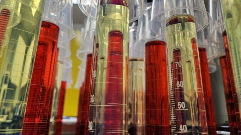 Oil Analysis by Eurofins TestOil